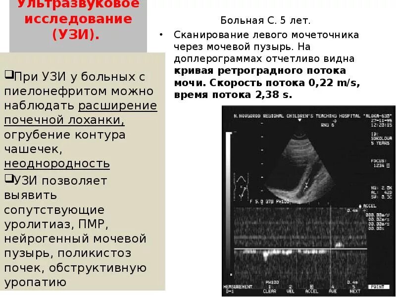 Хр пиелонефрит на УЗИ. УЗИ почек и мочевого пузыря при пиелонефрите. Обструктивный пиелонефрит на УЗИ. • УЗИ почек и мочевого пузыря пиелонефрит. После узи болит