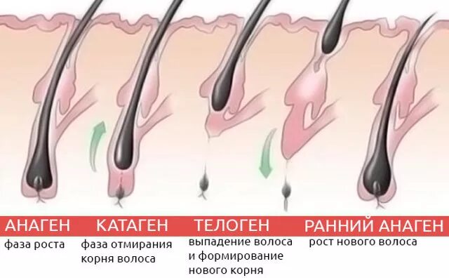 Растут корни волос. Волосяная луковица. Волос с волосяной луковицей. Волос вырывается с луковицей.