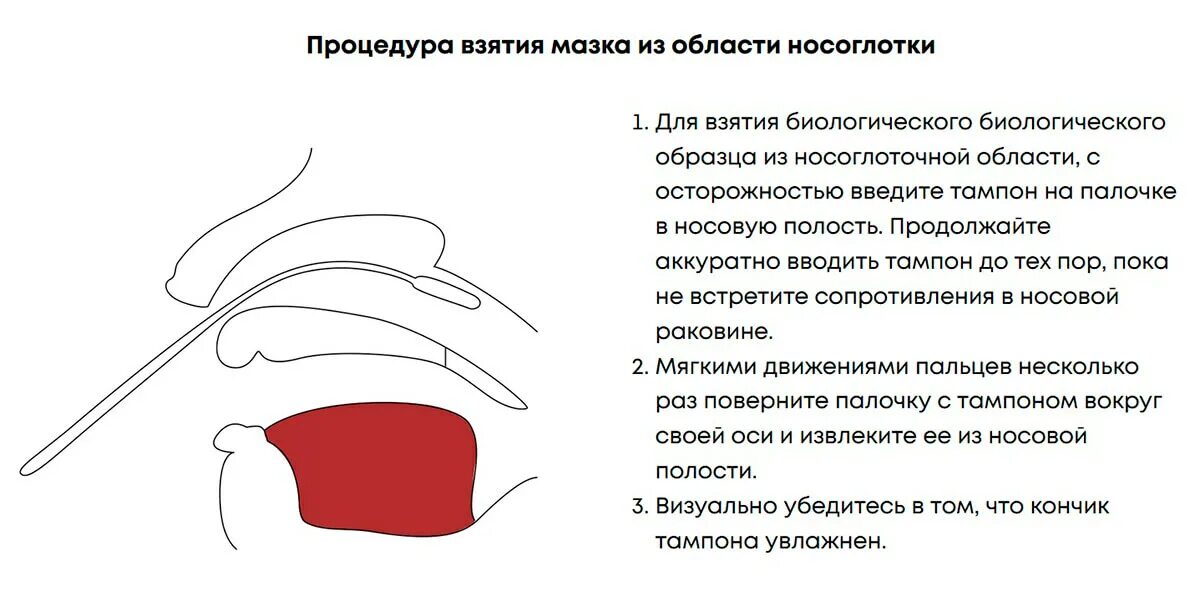 Простой ковид. Взятие мазка из носоглотки. Забор мазков из носоглотки алгоритм. Мазок из носоглотки алгоритм.