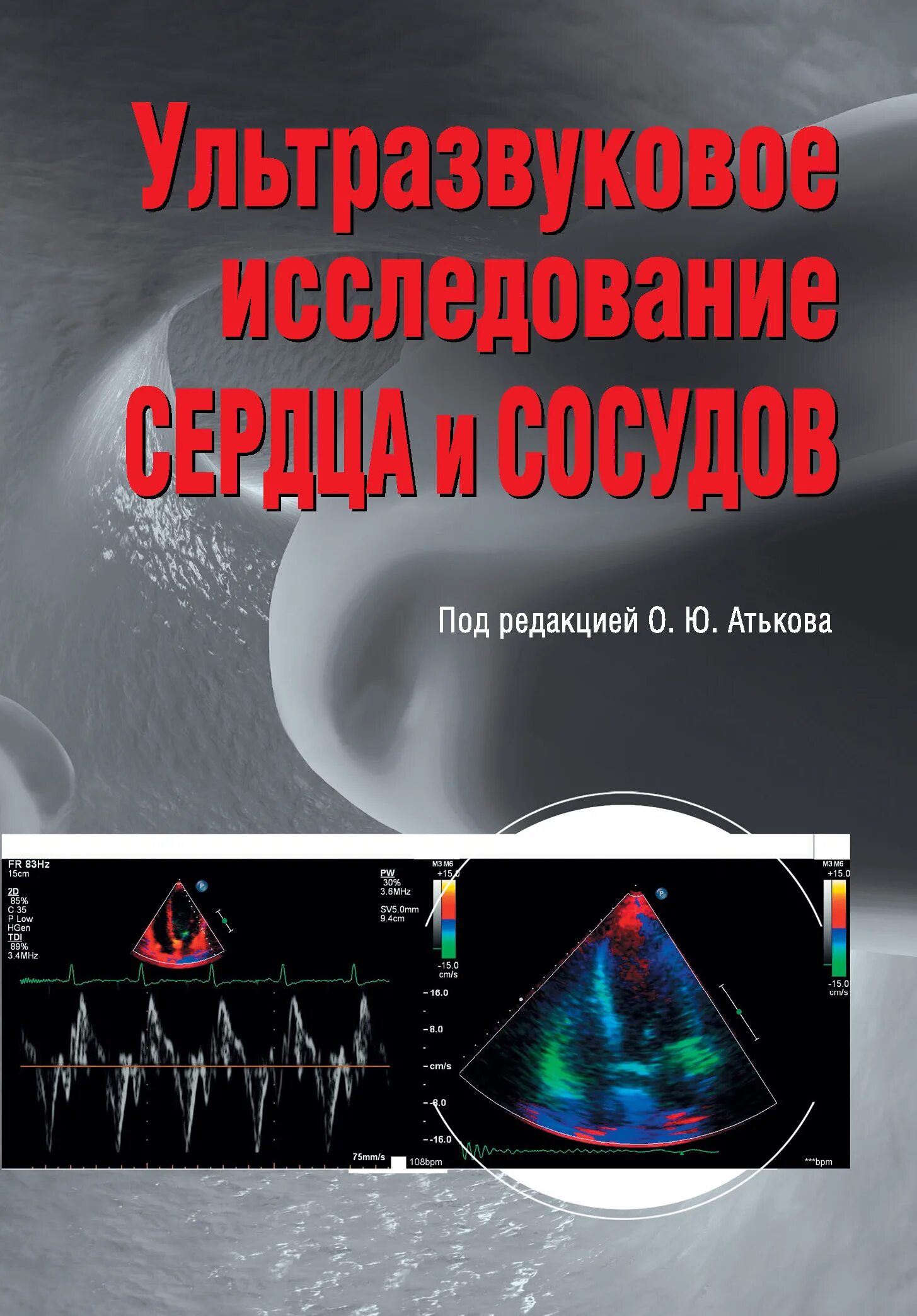 Ультразвуковая диагностика вен и сосудов книга. Ультразвуковое исследование сердца и сосудов. УЗИ сердца. Ультразвуковое исследование сосудов книги. Ультразвуковая диагностика книги