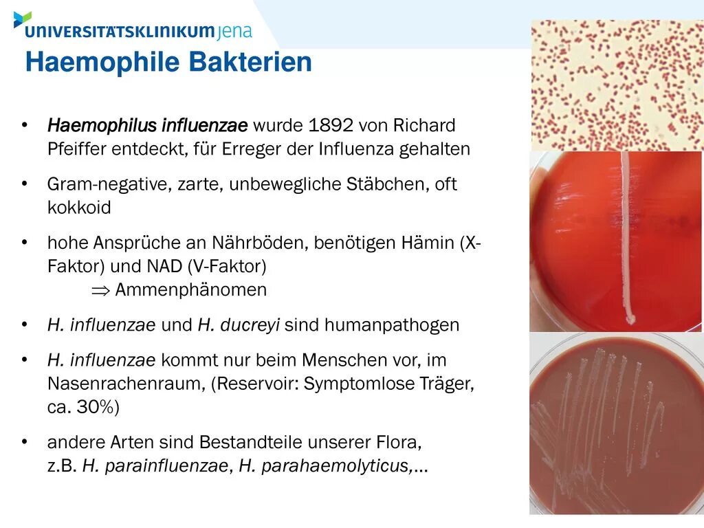 Haemophilus spp у мужчин. Haemophilus influenzae микробиология. Гемофилус парагемолитикус. Геном бактерии Haemophilus influenzae.
