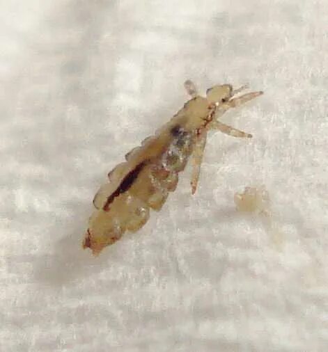 Сон белые вши. Сон белые вши. Головная вошь - pediculus capitis. Сон белые вши. Сон белые вши.