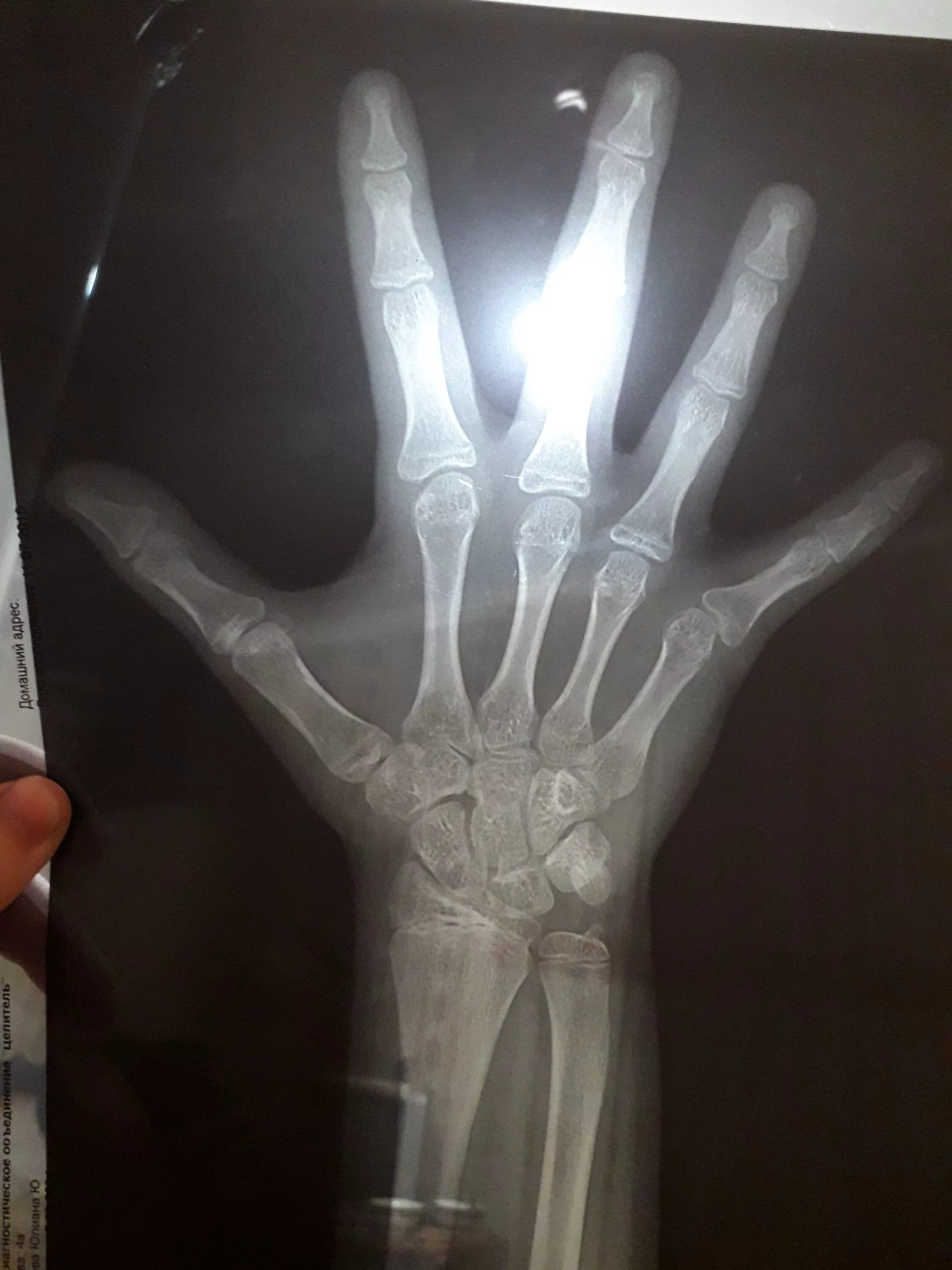 профессиональные зоны роста