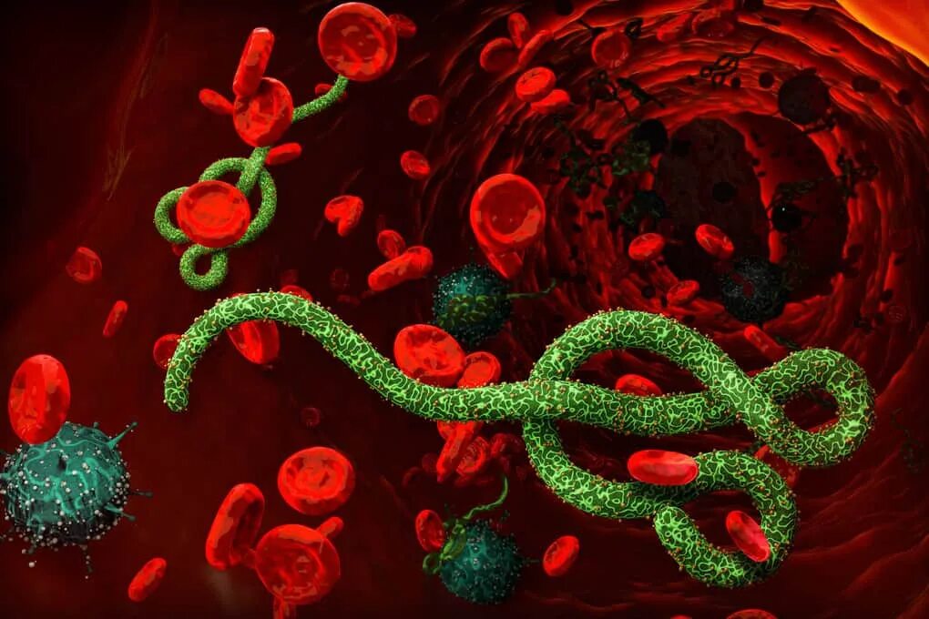 Бактерия лихорадки Эбола. Вирус Эбола под микроскопом. Геморрагическая лихорадка Эбола возбудитель. Опасные вирусы в мире