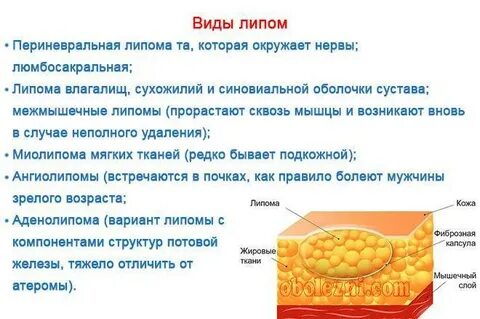 Как называется подкожная жировая