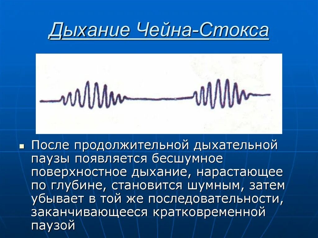 Источники когерентного излучения. Когерентность в волновой оптике. Картинки когерентная концепция. Когерентное дыхание. Патологические типы дыхания чейна стокса.