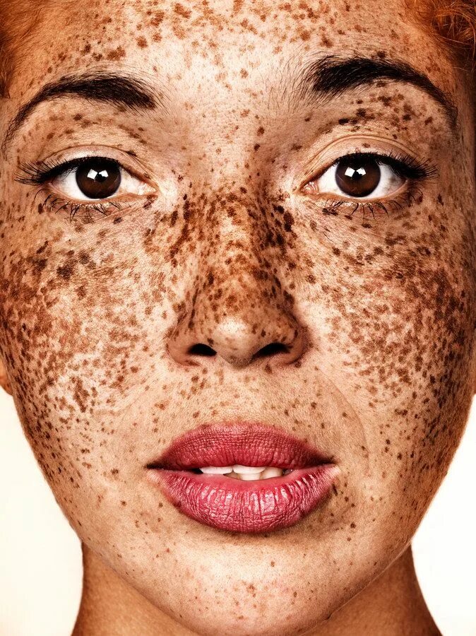 Freckles перевод. Редкие веснушки. Веснушки малозаметные.