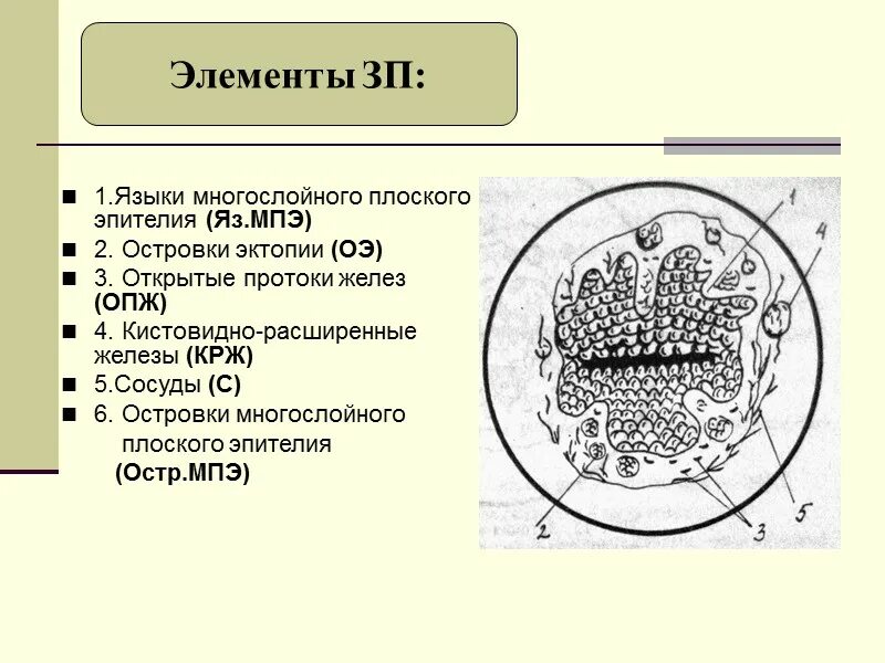 Мпэ орг. Эктопия цилиндрического эпителия. структура матки с мелкими крж. кольпоскопическое эктопия цилиндрического эпителия. мпэ-ми.
