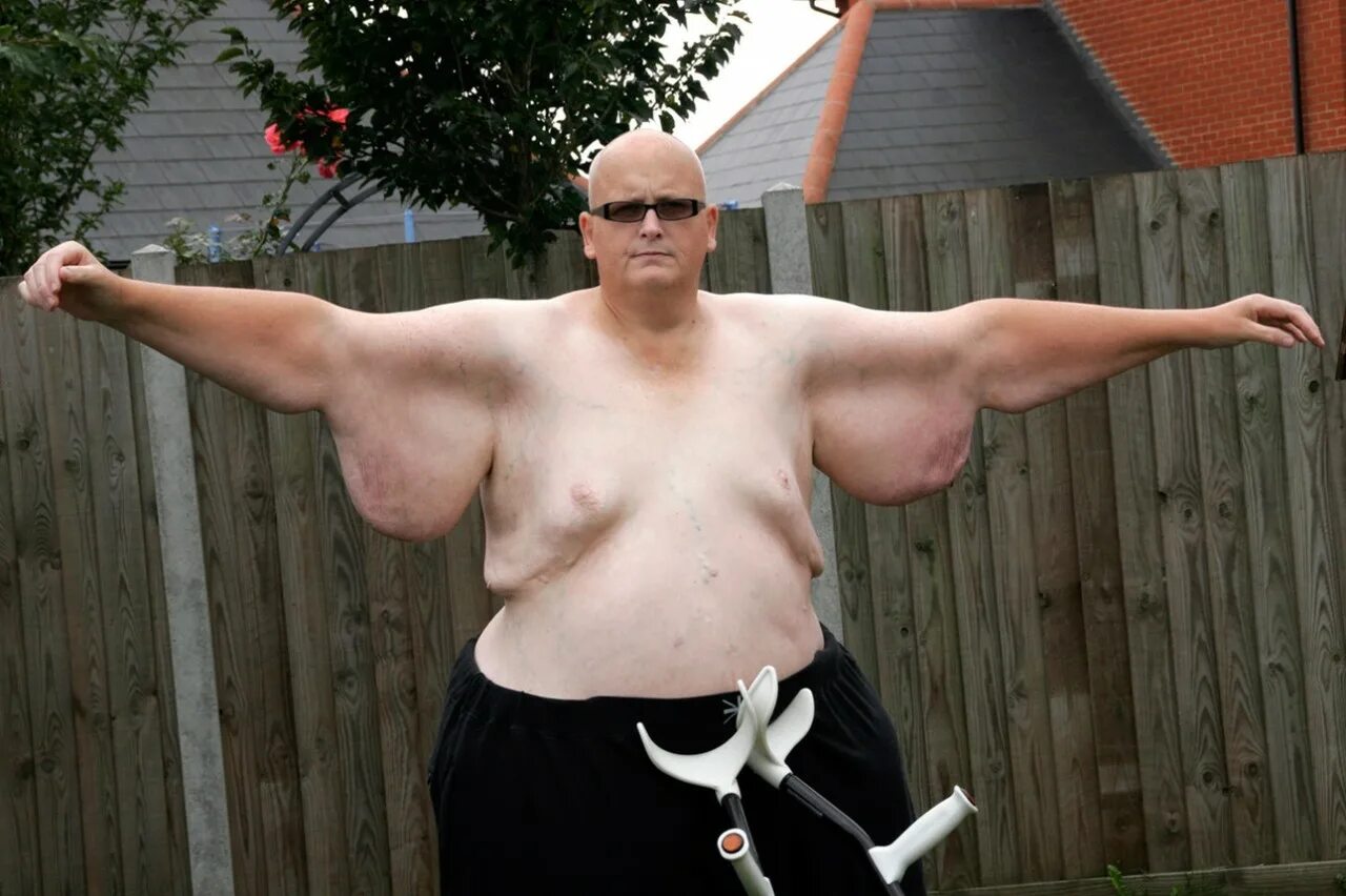 Стройный и полный человек. Толстый и худой. Толстяк худышку. Полная и стройная девушка. Тесс холидей худая и толстая.