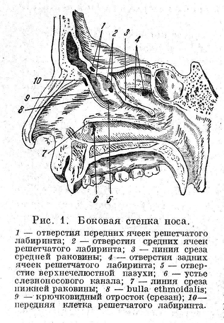 Полость рта костные стенки. Латеральная стенка носовой полости образована. Латеральная стенка полости носа кости. Латеральная стенка носа схема. Носовая полость анатомия кости.