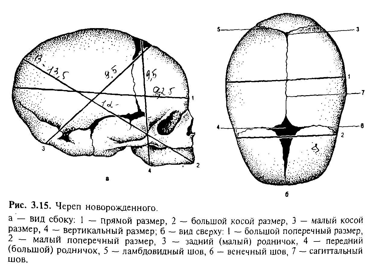Строение черепа плода кости швы роднички. Строение головки плода швы роднички. Череп новорожденного Размеры головки рисунок. Череп новорожденного роднички Размеры головки новорожденного.