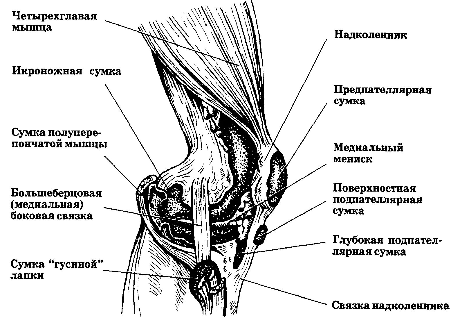 Синовиальные сумки коленного сустава анатомия. Бурсит гусиной лапки коленного сустава анатомия. Поверхностная гусиная лапка коленного сустава. Поверхностная гусиная лапка коленного сустава анатомия. Лечим гусиную лапку