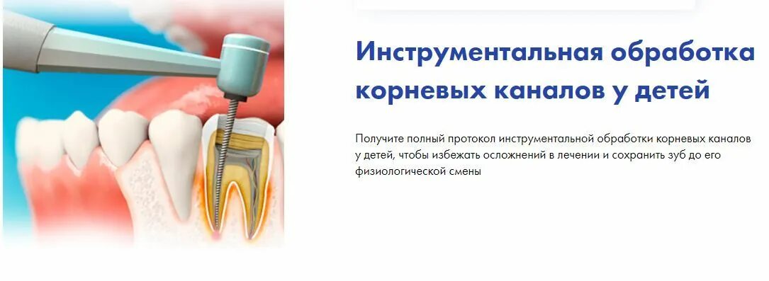 Обработка корневых каналов техники
