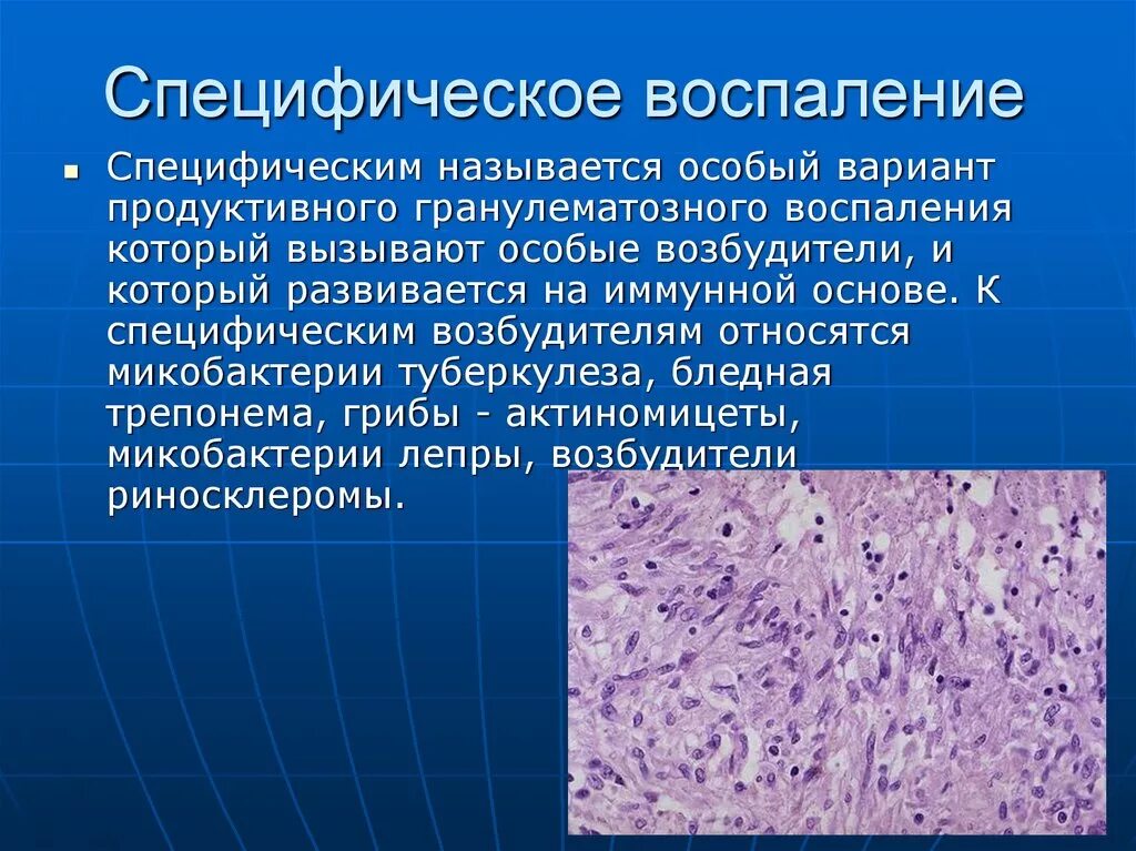 Чем грозит воспаление. Гранулематозное воспаление патанатомия. Специфическое воспаление. Продуктивное гранулематозное воспаление. Специфическое хроническое воспаление.