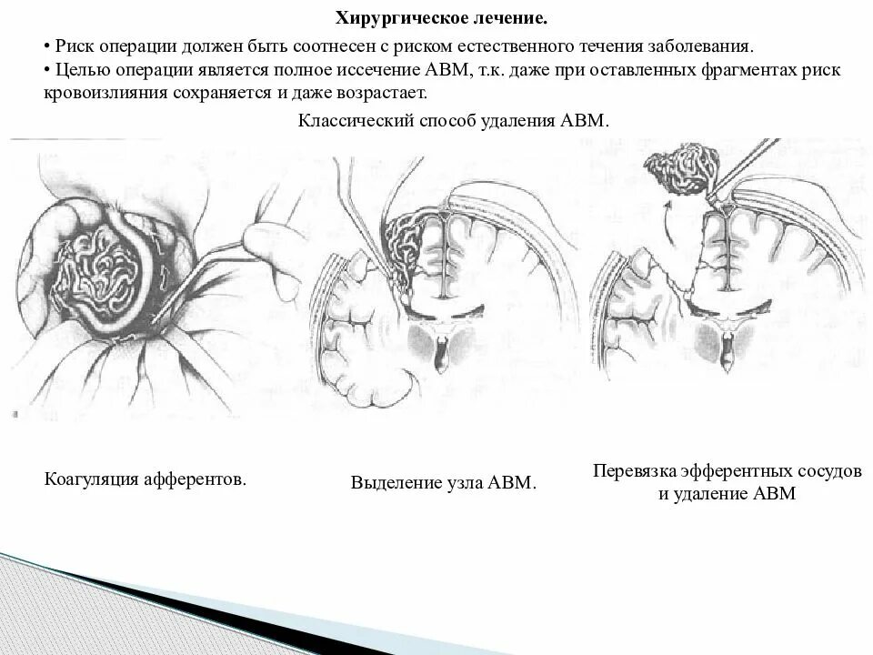Операция берча. Резекция мальформации. артериально венозная мальформация. артериовенозная мальформация операция.