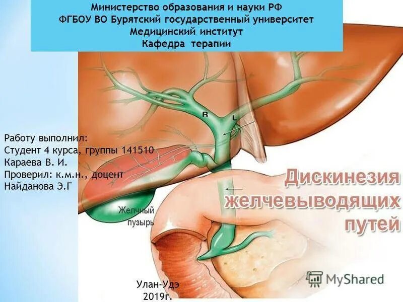 Гипотонический желчный пузырь