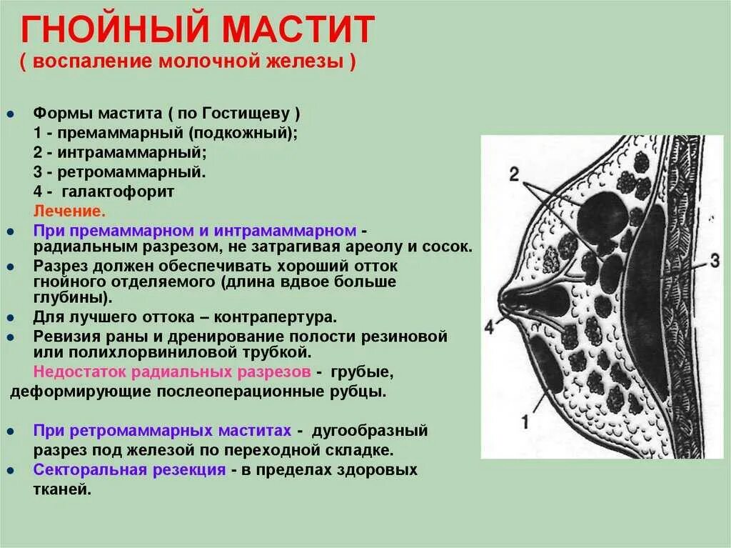 Лечение гнойного мастита. Субареолярный Гнойный мастит. Топографическая анатомия и Оперативная хирургия молочной железы. Интрамаммарный Гнойный мастит. Мастит топографическая анатомия.