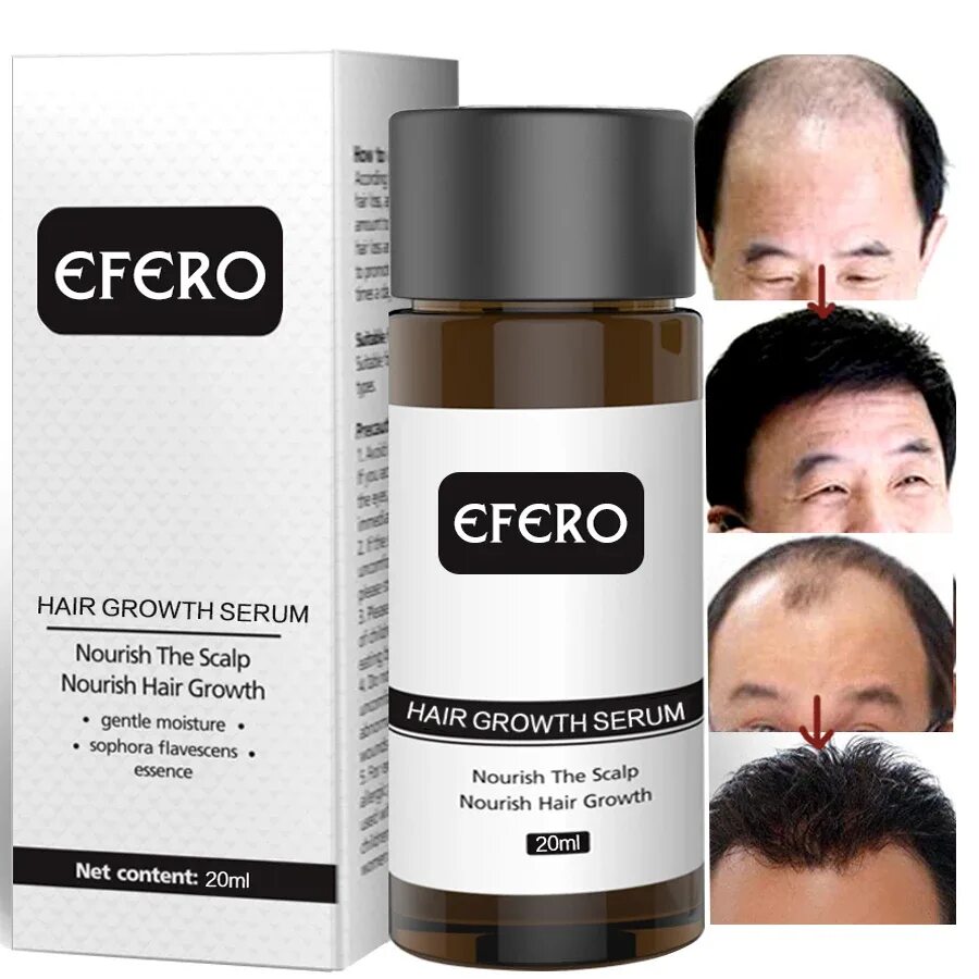 Сыворотка для волос для мужчин. Hair growth Serum. Сыворотка от облысения для мужчин. Efero. Efero для волос отзывы.