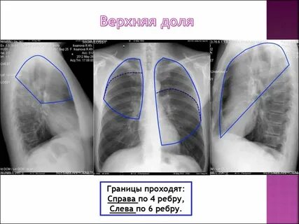 Справа доли в