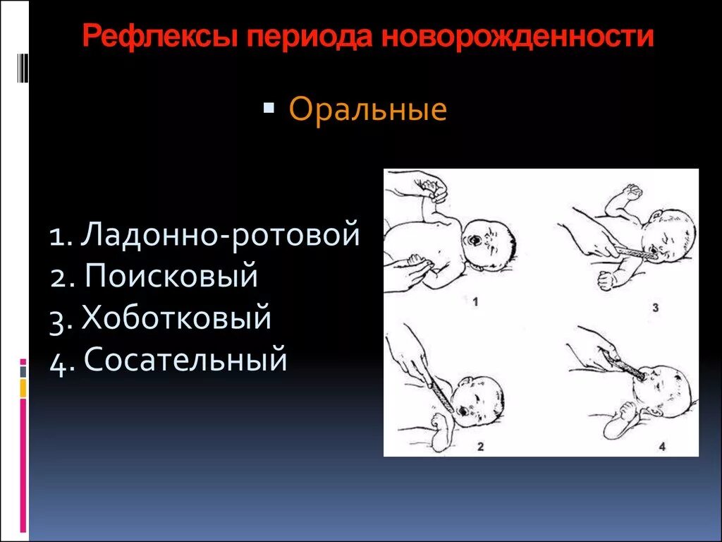 Основные периоды новорожденности. Ладонно рото головной рефлекс. хоботковый рефлекс у новорожденных. сосательный рефлекс, хоботковый рефлекс. рефлексы периода новорожденности.