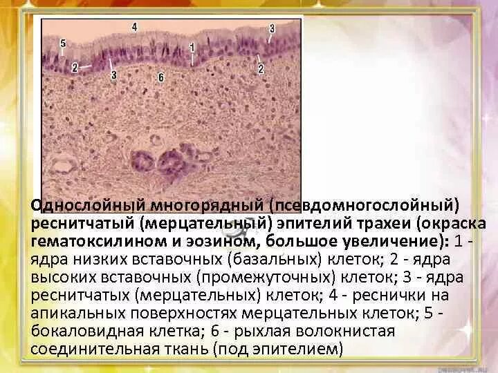 Эпителий с увеличенными ядрами. Эпителий с увеличенными ядрами. Мерцательный эпителий кишечника беззубки препарат. Что такое полиморфные клетки эпителия. Метаплазированный эпителий цитология.