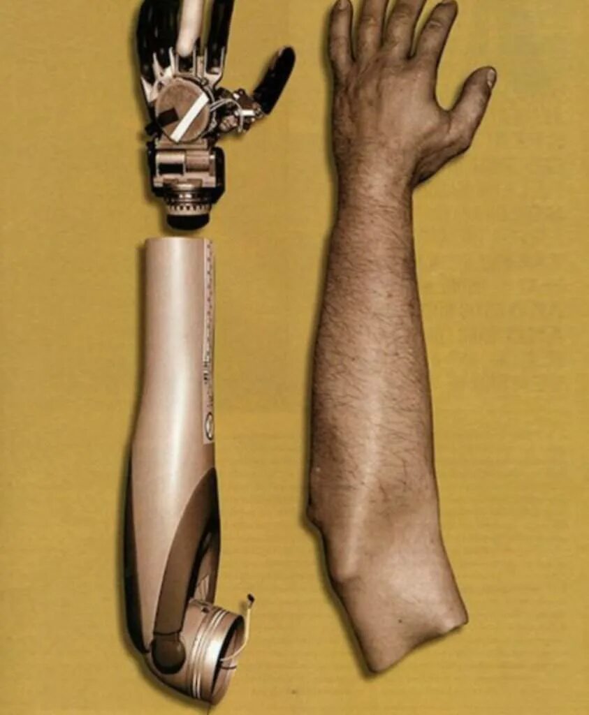 Бионический протез кисти. Бионический протез руки bebionic. Механический протез руки. Искусственная рука.