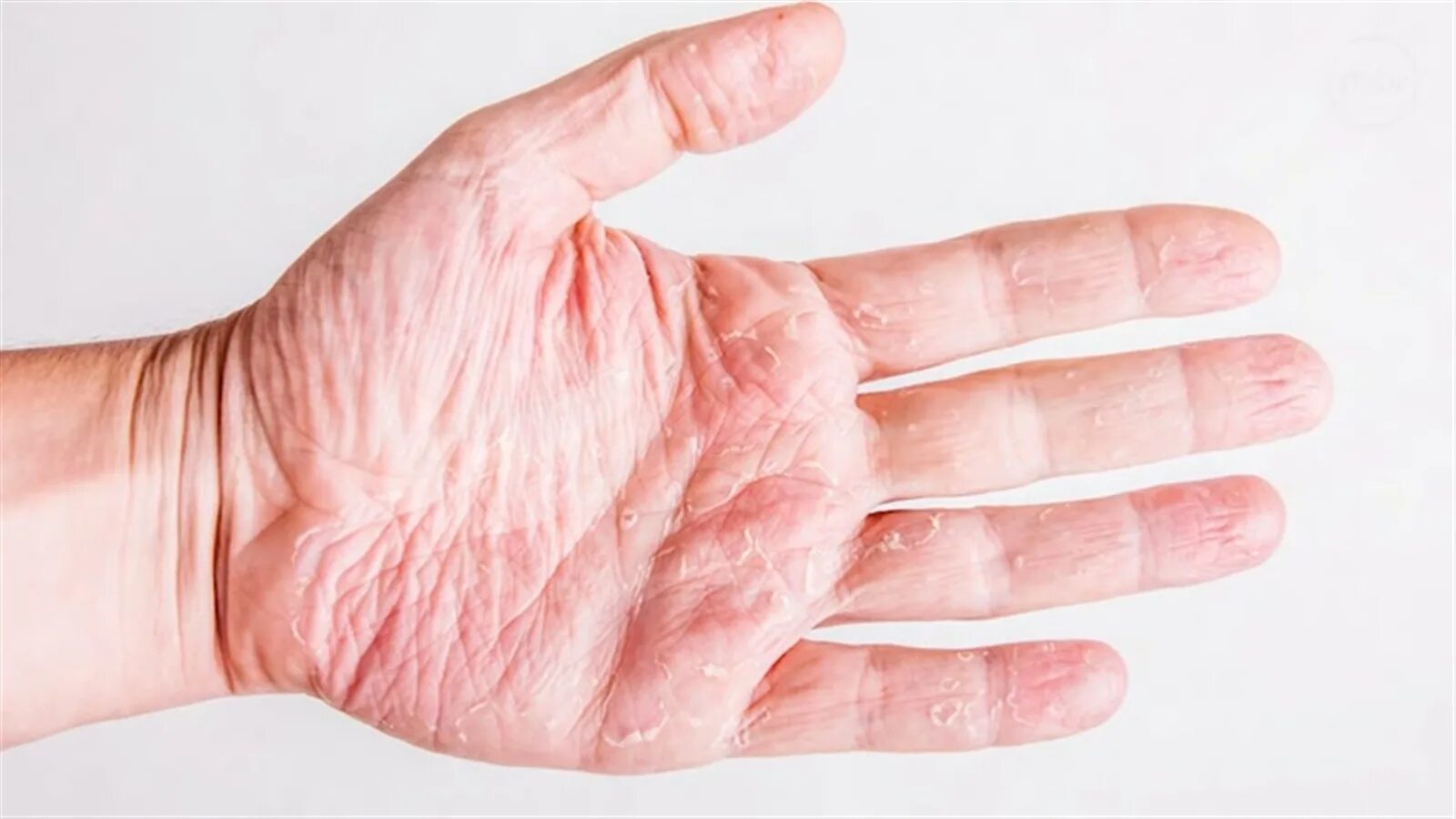 кожа рук и земля