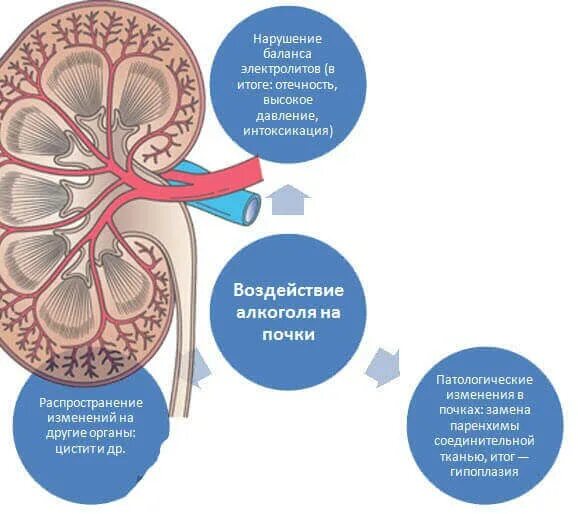 Почка влияет на печень. Влияние спирта на почки.
