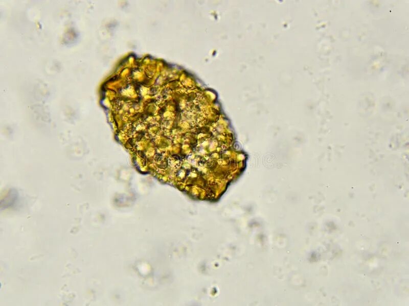 Споры в кале у взрослого. Ascaris lumbricoides яйца микроскоп. Яйца аскарид микроскопия. Яйца Ascaris lumbricoides в Кале.