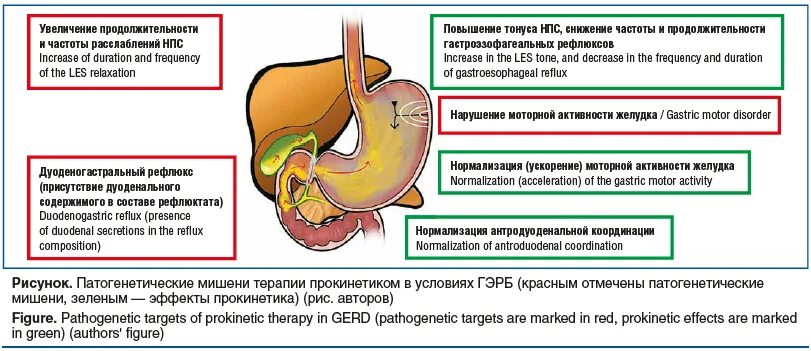 Имбирь при ГЭРБ. Смородина при ГЭРБ. Альфазокс при рефлюксе