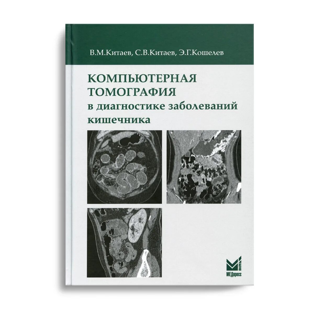 Обследование кт кишечника. Компьютерная томография в диагностике заболеваний кишечника китаев. кенинга компьютерная томография. компьютерная томография книга. книги по кт диагностике.