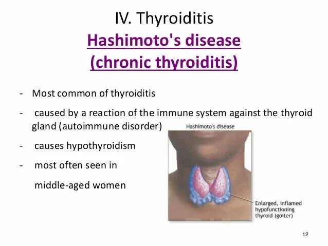 Хашимото болезнь у женщин. Тиреоидита Хашимото у женщин.