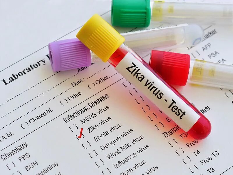 Virus testing