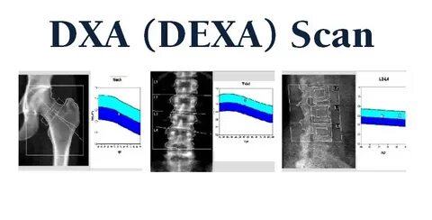 Portal dxa az