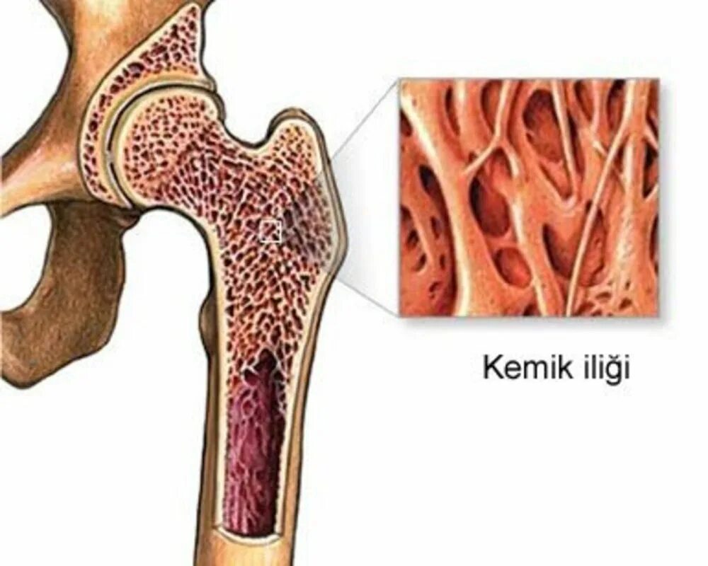 Красный мозг костей. Костный мозг, Medulla ossium. Губчатые кости красный и костный мозг. Красный костный мозг трубчатых костей. Красный костный мозг в ячейках губчатого вещества.