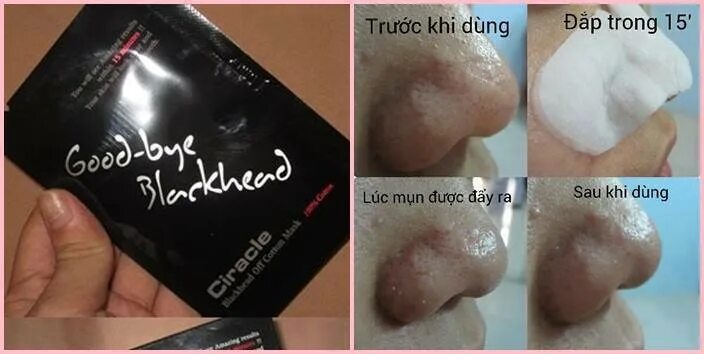 Ciracle Goodbye Blackhead. Диски Goodbye Blackhead. Корейская от черных точек. Blackhead инструкция по применению