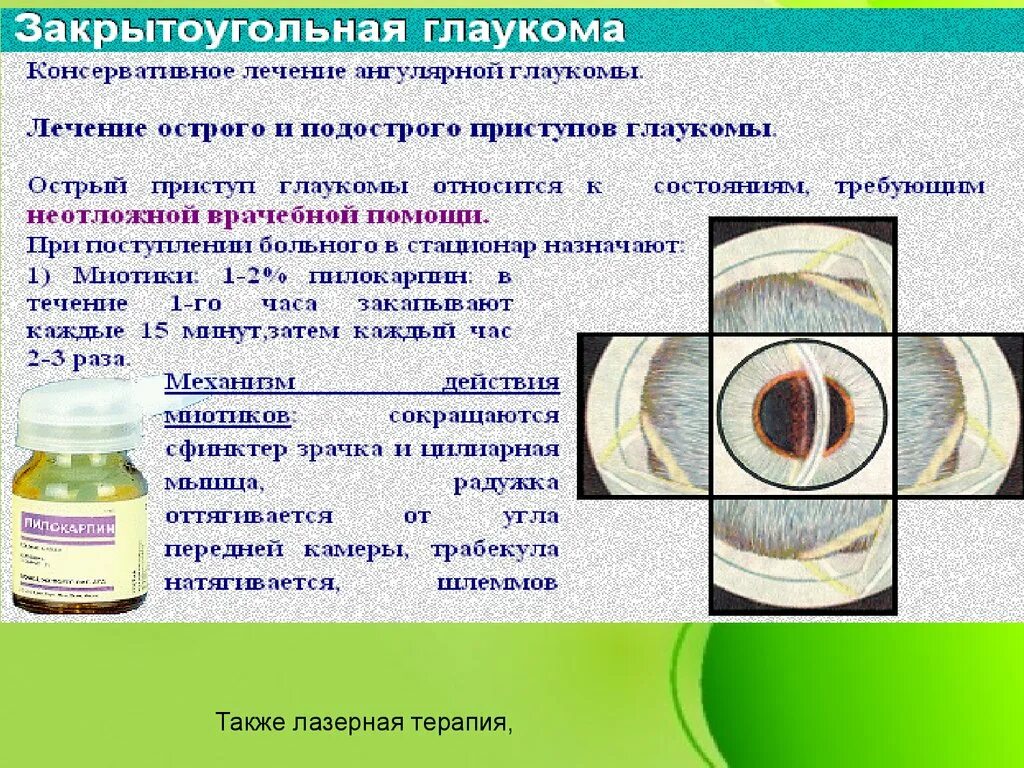 Глаукома актуальность проблемы. Лечение закрытоугольной глаукомы. При глаукоме можно применять