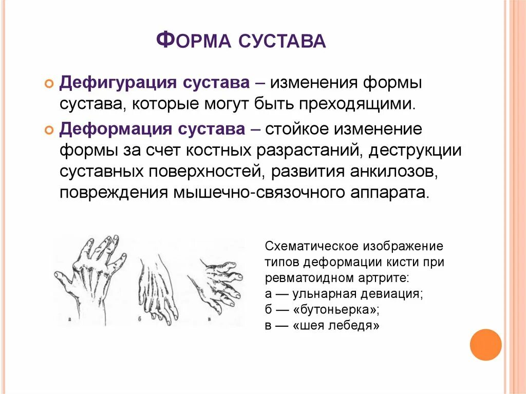 Изменение формы сустава. Ульнарная девиация в суставах кистей. Деформация и дефигурация сустава. Изменение формы руки