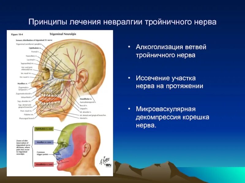 Как вылечить нерв на лице. Поражение тройничного нерва неврология. терапия невралгии тройничного нерва. neuralgia тройничный нерв. микроваскулярная декомпрессия корешка тройничного нерва.