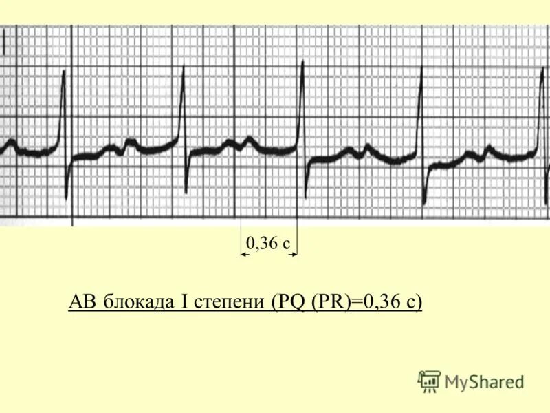 Law of cosines. Pr pq. Pr pq. анализ pq. Pr pq.