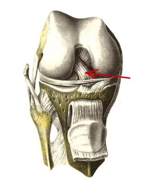 Крестообразные связки бедра. Lig. patellae анатомия. cruciatum anterius. крестовидные связки коленного сустава латынь. крестообразные связки коленного сустава латынь.