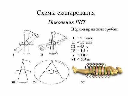 Схема кт