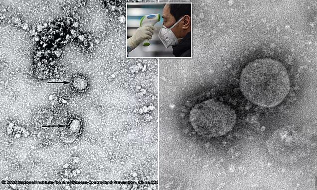 Как выглядит ковид 19 под микроскопом Dosya:Novel Coronavirus SARS-CoV-2 (49534370233).jpg Vikipedi