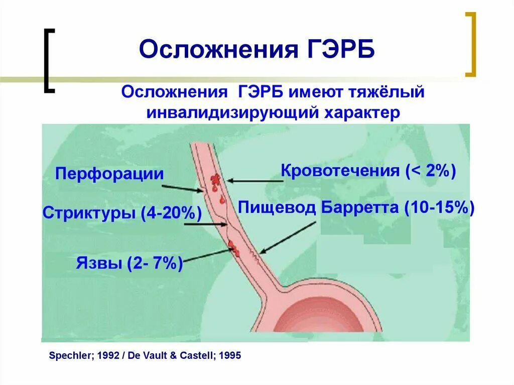 Желудочный сок в пищеводе