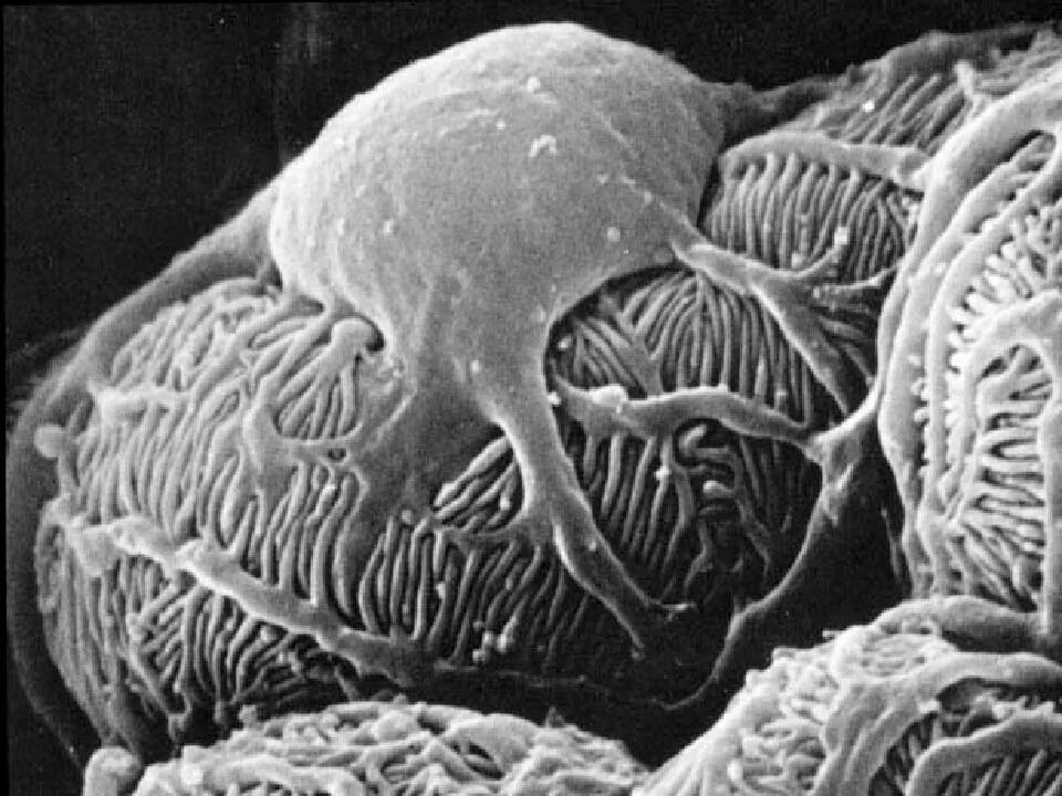 Подоциты. Подоциты. Строение гломерулярной базальной мембраны. Фильтрационный барьер почечного тельца гистология. Подоциты.
