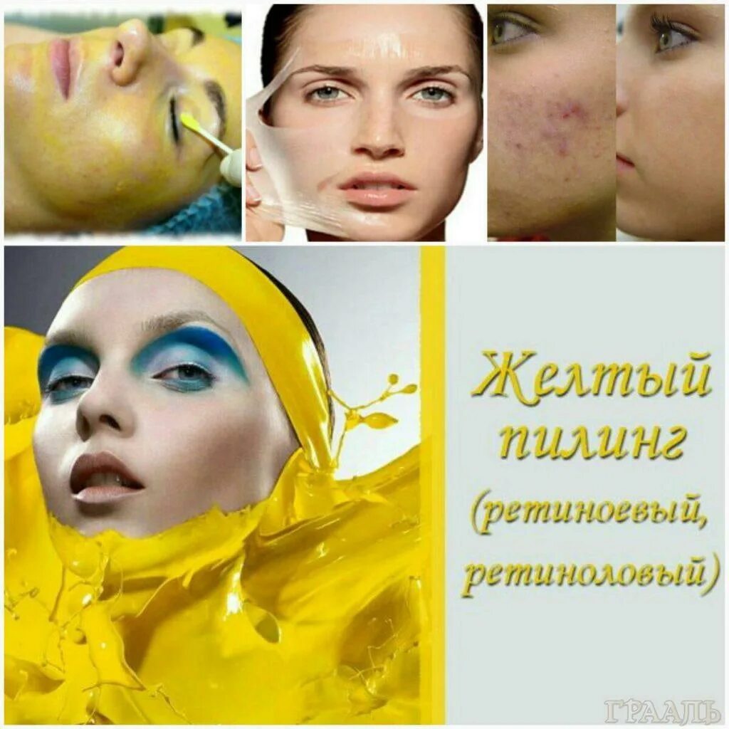 Желтый ретиноевый пилинг