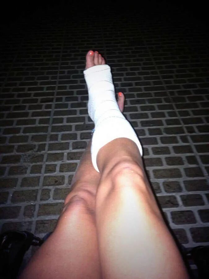 сломанные ноги у девочки на входе текст