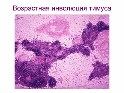Инволюция тимуса начинается