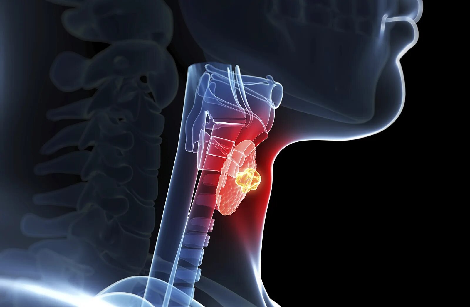 Носовая полость гортань трахея бронхи легкие. Попадание пищи в трахею. Психогенный кашель. Строение пищевода и трахеи человека. Что если пища попала в дыхательные пути.