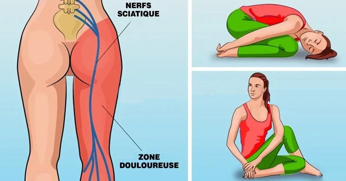Можно ли греть ягодицу. Йога для седалищного нерва. Упражнения для седалищного нерва. Упражнения йоги для седалищного нерва. Растяжка мышц седалищного нерва.